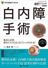 白内障 - 眼科専門書店 オー・ビー・エス online shop
