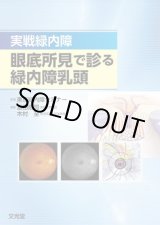 緑内障 眼科 英語 本 51hnlv-x96L.jpg