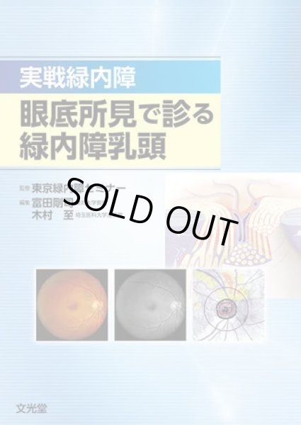 画像1: 実戦緑内障　眼底所見で診る緑内障乳頭 (1)