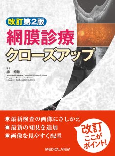 網膜診療クローズアップ 改訂第2版 | 柳 靖雄 |本 | 通販 | Amazon