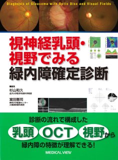 実戦緑内障 眼底所見で診る緑内障乳頭 [単行本] 東京緑内障セミナー、 剛司，富田; 至，木村 実戦緑内障 眼底所見で診る緑内障乳頭 - 眼科専門書店 オー