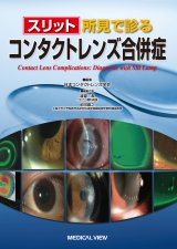 コンタクトレンズ - 眼科専門書店 オー・ビー・エス online shop