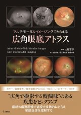 OCT眼底診断学 第3版 眼科 商品詳細ページ | メディカルブックセンター