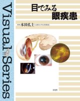眼科学　第2版 眼科学 第2版 |本 | 通販 | Amazon