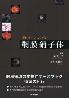 悩みを解決！網膜硝子体 手術道場 [MB Oculista no.147] - 眼科