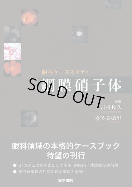 画像1: 眼科ケ－ススタディ網膜硝子体 (1)