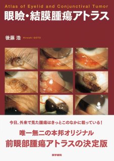 【裁断済み】眼科診療エクレール　ドライアイと涙道疾患ナビゲート 3 最新 ドライアイと涙道疾患ナビゲートー「涙」の問題はこの1冊