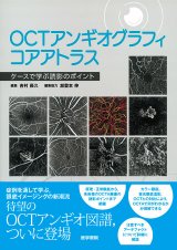 画像診断・OCT - 眼科専門書店 オー・ビー・エス online shop