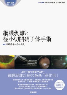 実況！ 硝子体手術Tips165 | オンラインストア｜看護・医学新刊
