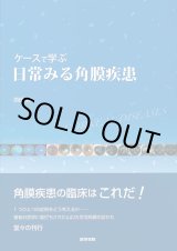 ケースで学ぶ日常みる角膜疾患 [単行本] 西田 輝夫 ケースで学ぶ 日常みる角膜疾患 - 眼科専門書店 オー・ビー・エス