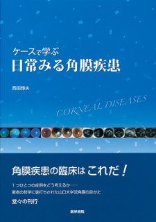 角結膜診療のストラテジー　見る・知る・考える症例検討　裁断済み　眼科 三輪書店オンラインショップ / 角結膜診療のストラテジー 見る