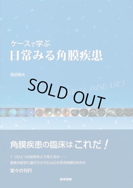 画像1: ケースで学ぶ 日常みる角膜疾患 (1)