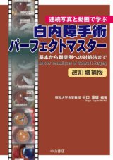 白内障 - 眼科専門書店 オー・ビー・エス online shop