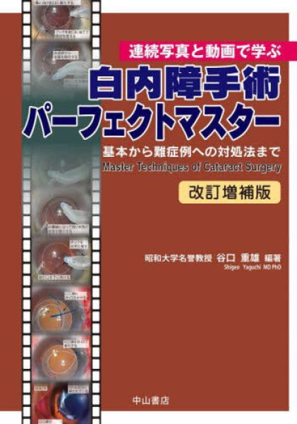 画像1: 連続写真と動画で学ぶ　白内障手術パーフェクトマスター　-基本から難症例への対処法まで-　改訂増補版 (1)
