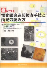 検査・診断・治療法 - 眼科専門書店 オー・ビー・エス online shop