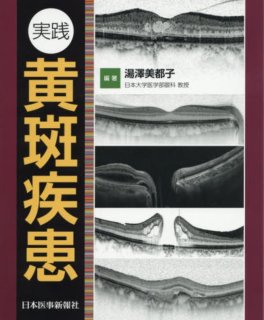 加齢黄斑変性 第2版 - 眼科専門書店 オー・ビー・エス online shop