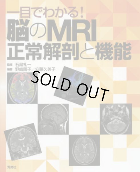 画像1: 一目でわかる！脳のMRI正常解剖と機能 (1)