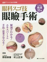 【裁断済】 スキル美容外科手術アトラス 眼瞼 第2版 Amazon.co.jp: スキル美容外科手術アトラス 眼瞼 第2版 : おもちゃ