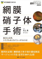 (裁断済み)眼科プラクティス 17 みんなの硝子体手術 裁断済み)眼科プラクティス 17 みんなの硝子体手術