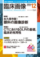 画像診断・OCT - 眼科専門書店 オー・ビー・エス online shop