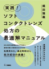 コンタクトレンズ処方マニュアル 改訂第2版/南江堂/中島章