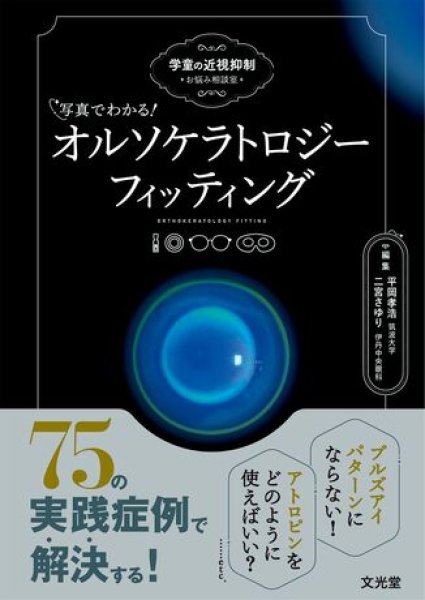 画像1: 写真でわかる！ オルソケラトロジーフィッティング　学童の近視抑制 お悩み相談室 (1)