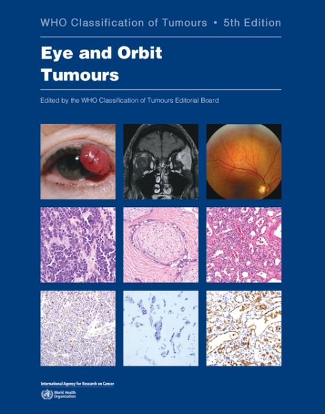 画像1:  WHO Classification of Tumours Eye & Orbit Tumours (1)