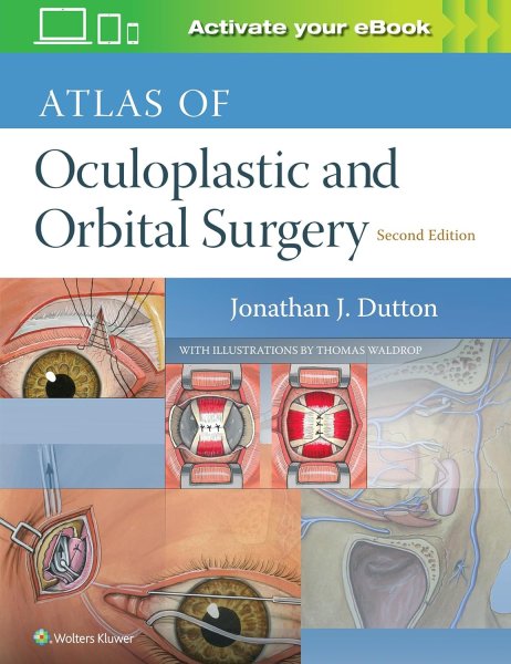 画像1: Atlas of Oculoplastic and Orbital Surgery 2nd.ed. (1)