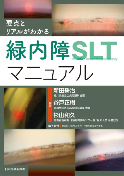 画像1: 要点とリアルがわかる　緑内障SLTマニュアル (1)