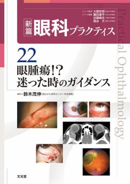 画像1: 眼腫瘍！？　迷った時のガイダンス　[新篇眼科プラクティス  22] (1)