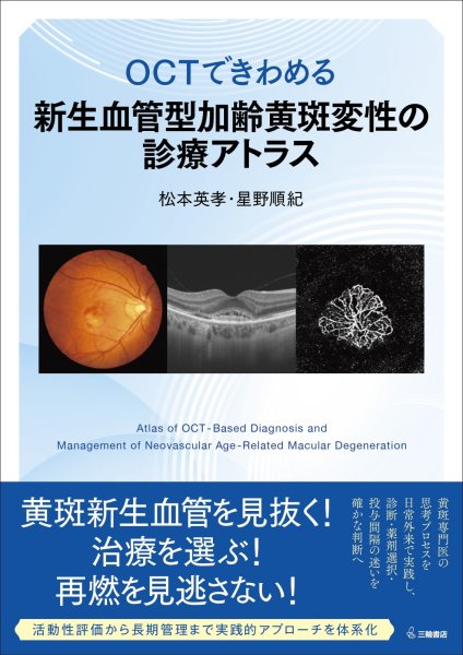 画像1: OCTできわめる 新生血管型加齢黄斑変性の診療アトラス (1)