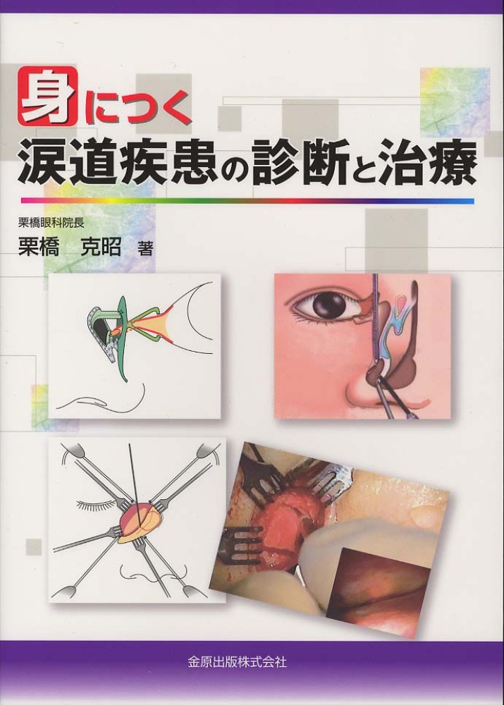 身につく涙道疾患の診断と治療