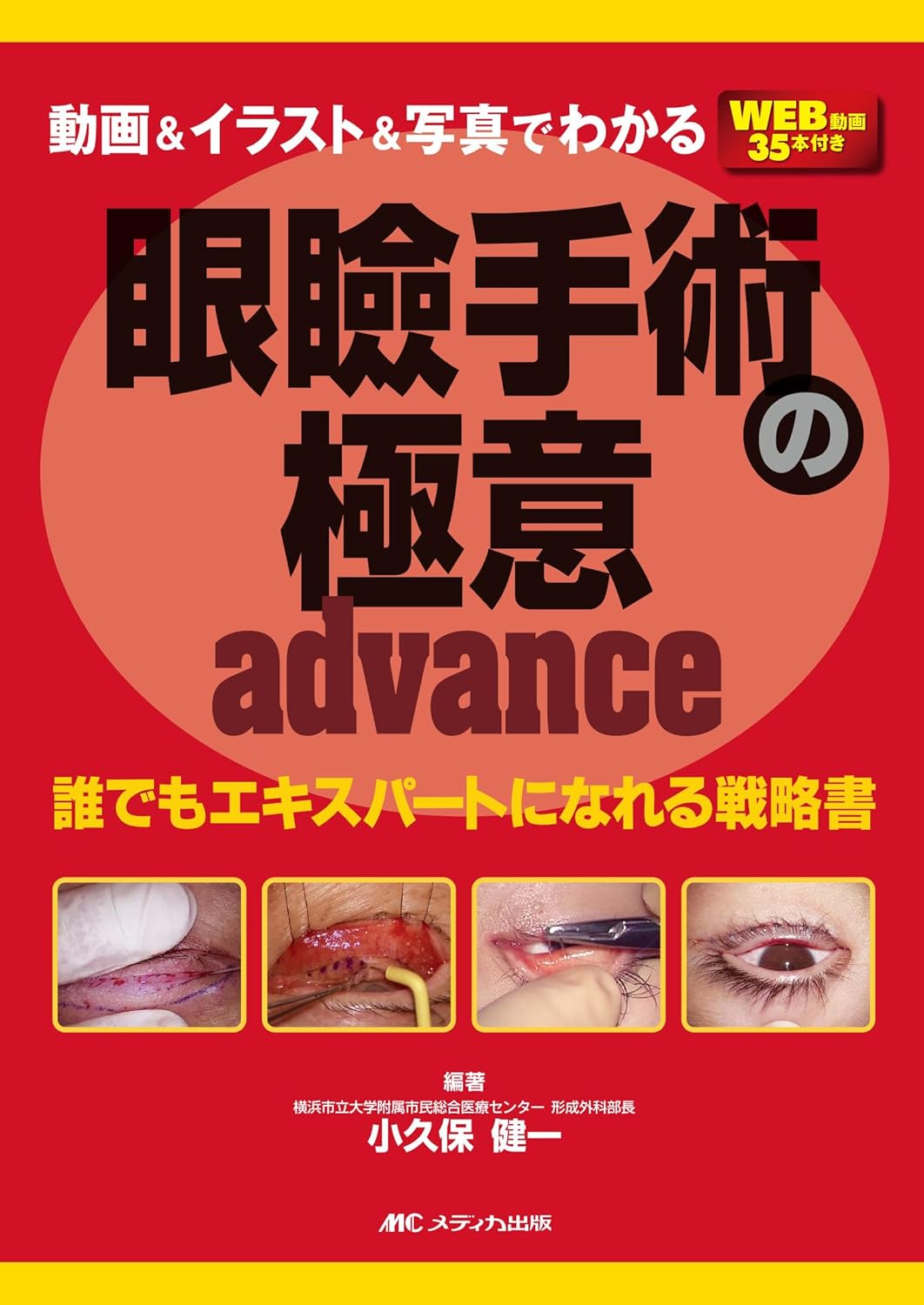 動画＆イラスト＆写真でわかる 眼瞼手術の極意 advance（ご予約商品：2025年4月末発売予定）